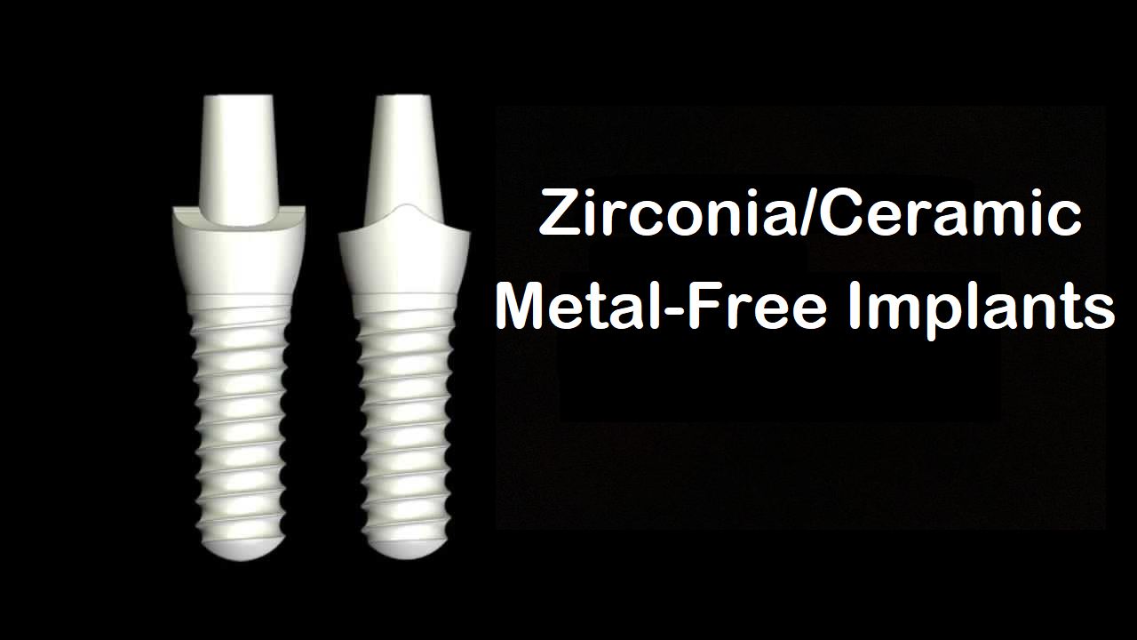 Zirconia Ceramic Implants Pic