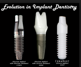 Dental Implants: An Integrative Perspective